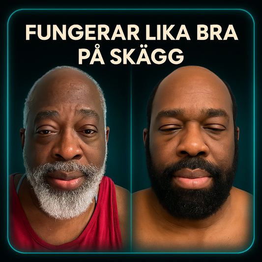 Så får du skägget att se yngre och fräschare ut